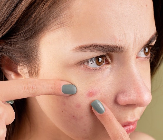 Skin problems in summer can include acne